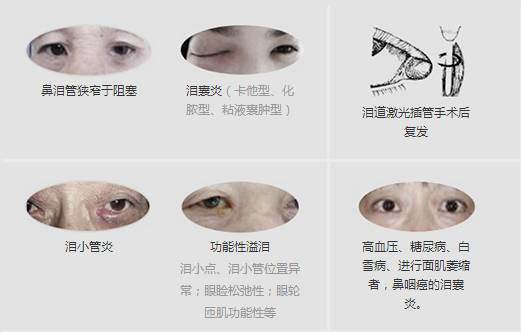 12月17日，普瑞集團淚道專家來疆親診，預約請速！