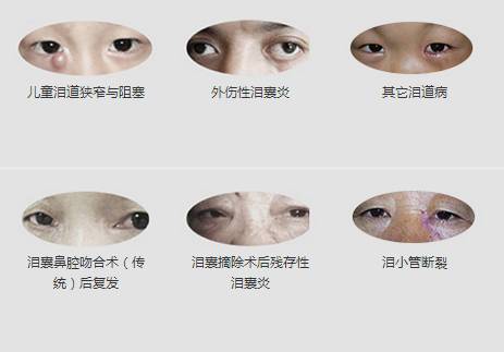 12月17日，普瑞集團淚道專家來疆親診，預約請速！